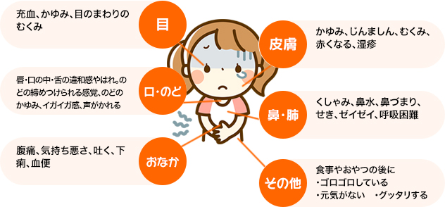 食物アレルギーに関する基礎知識 その３ どんな症状が出るの スクスクのっぽくん